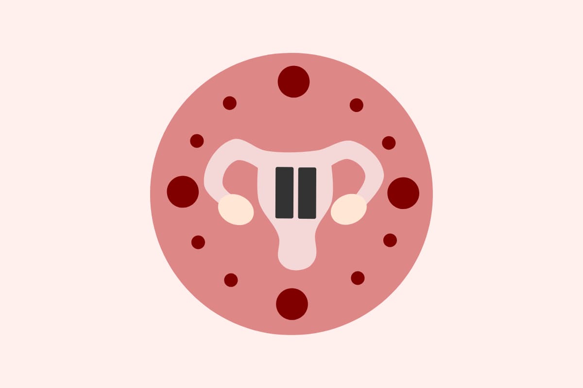 Wat is de menopauze?